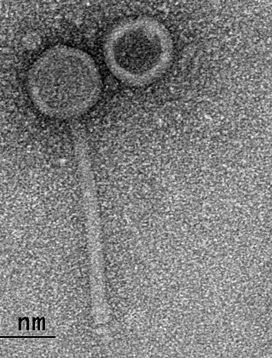 urmibajpai's tweet photo. Leads of this preprint: Buzzing minds with a poker face and each having a ta(i)le to tell! TEM @CSIR_CDRI. First authors are/were scholars @ANDCollegeDU. Thanks to all the coauthors; to @ICMRDELHI for the grant support. #B1mycobacteriophages #biofilm #genomeannotation #lysogeny https://t.co/WSZDw6qEPB