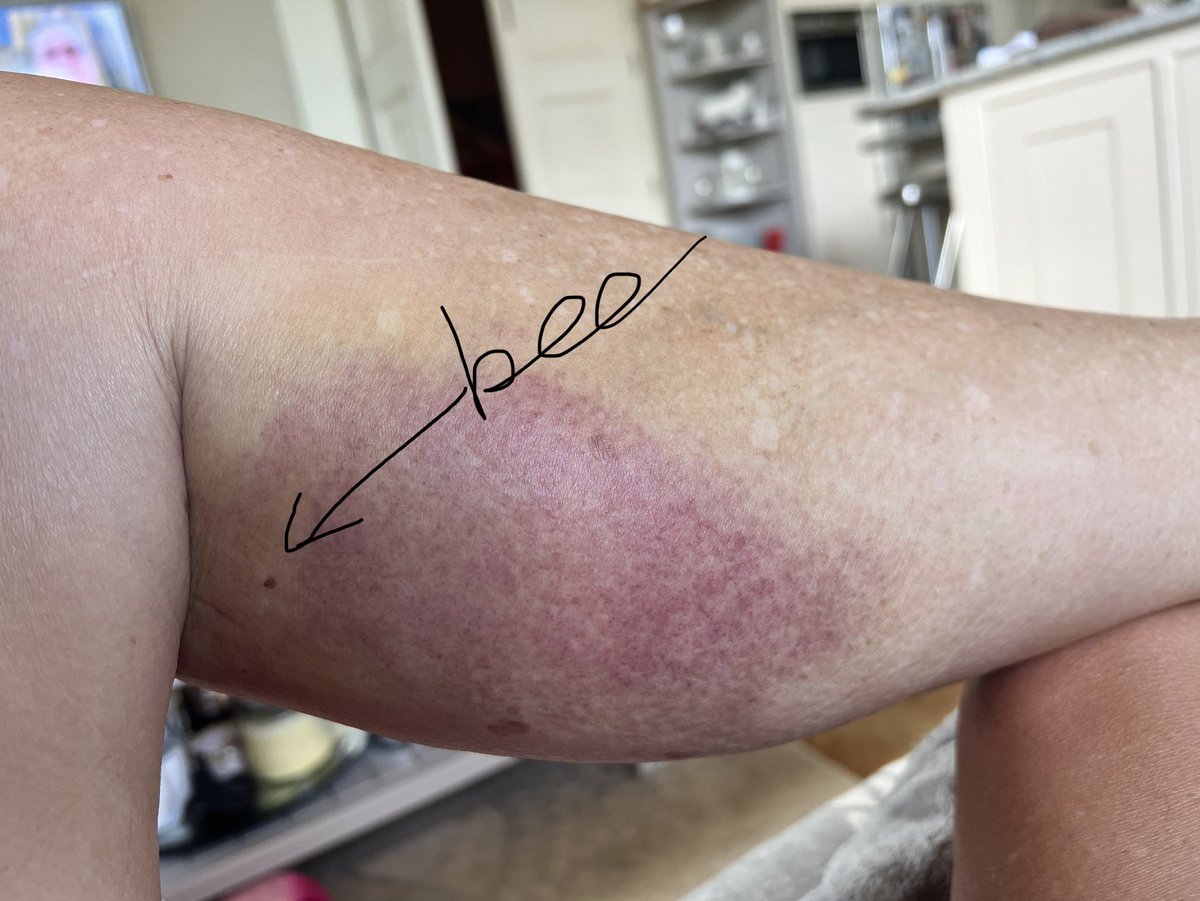 Sharron Davies HoL MBE tweet media