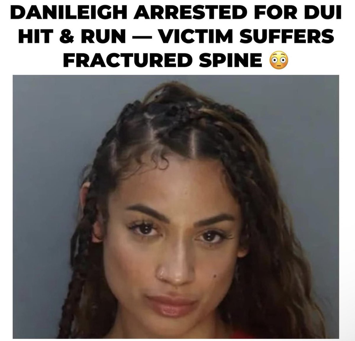 I lied #dababy did a good job leaving 
#danileigh

The singer, who's also DaBaby's ex/mother to one of his kids, was arrested early Tuesday morning in Miami Beach where police claim she was involved in a DUI hit & run, which ended with a serious back injury to the alleged victim