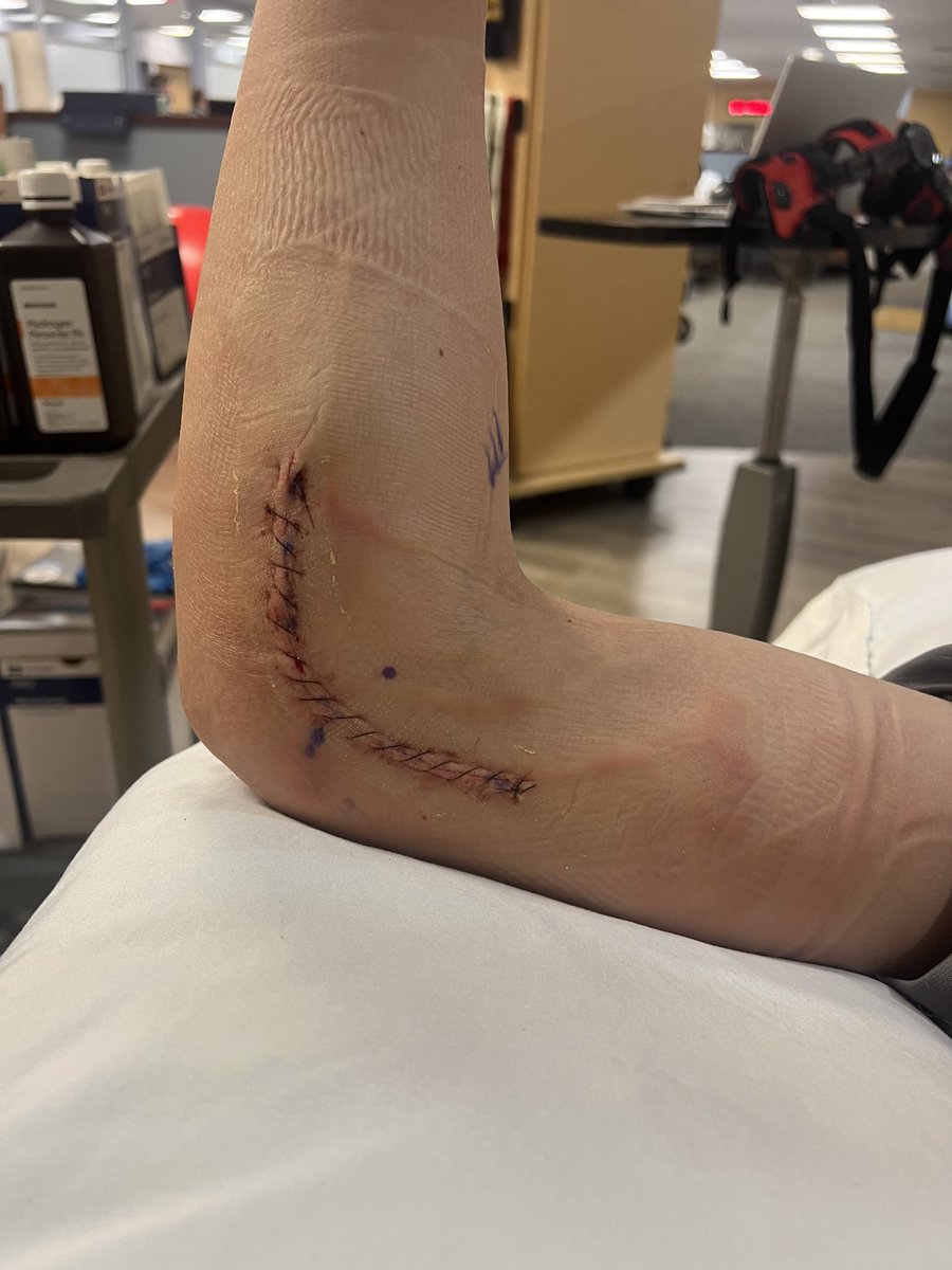 Drake_Bell24's tweet photo. Surgery went great thanks to Dr. Kremchek. @PPL_Lex @kma2026 @NhhsBaseball_ https://t.co/XPlvBeuh9q