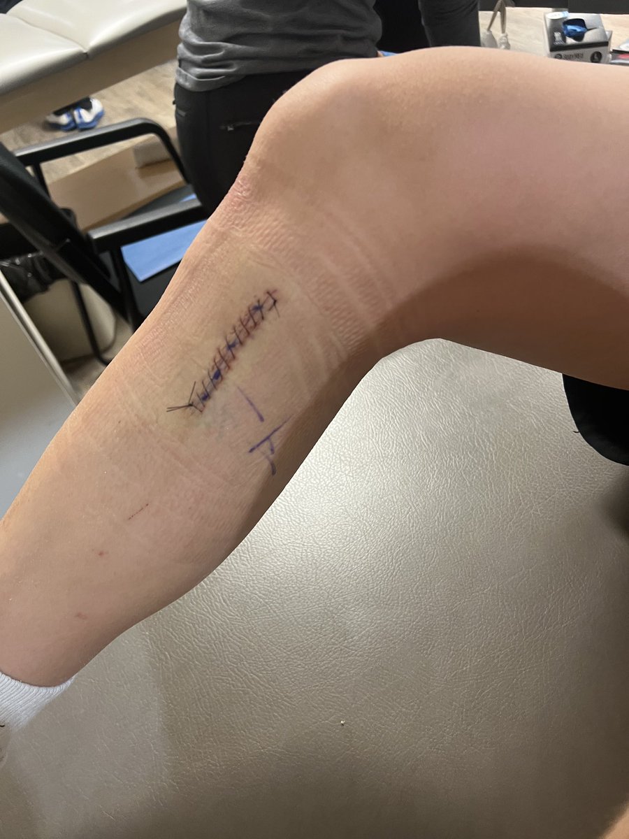 Drake_Bell24's tweet photo. Surgery went great thanks to Dr. Kremchek. @PPL_Lex @kma2026 @NhhsBaseball_ https://t.co/XPlvBeuh9q