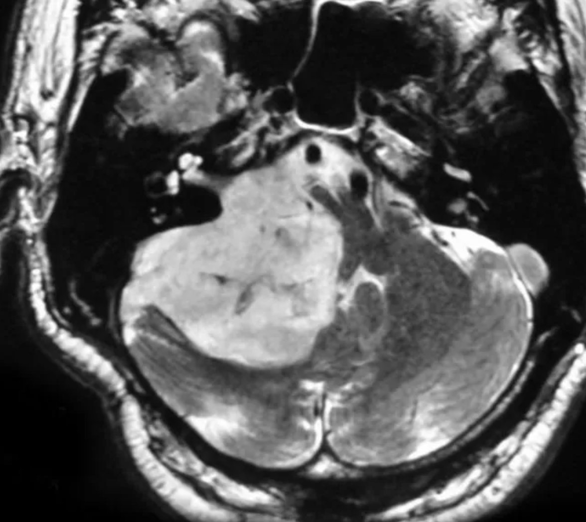 radRounds Radiology Network tweet media