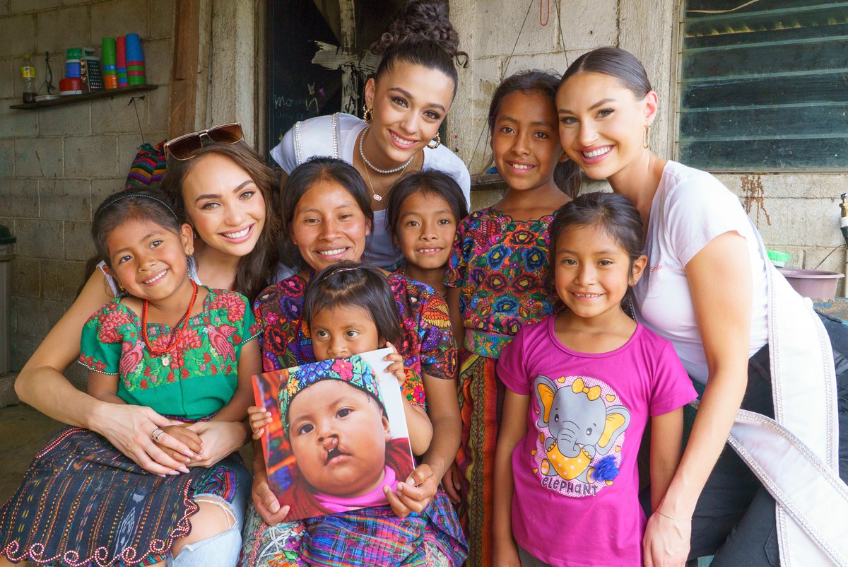 Changing the world one smile at a time❤️

Yesterday R'Bonney visited @Smiletrain cleft patients at home and had fun dying shirts.

In Guatemala, there are an estimated +500 births with cleft lip and/or palate each year. Since Smile Train began working in the country in 2007, more…
