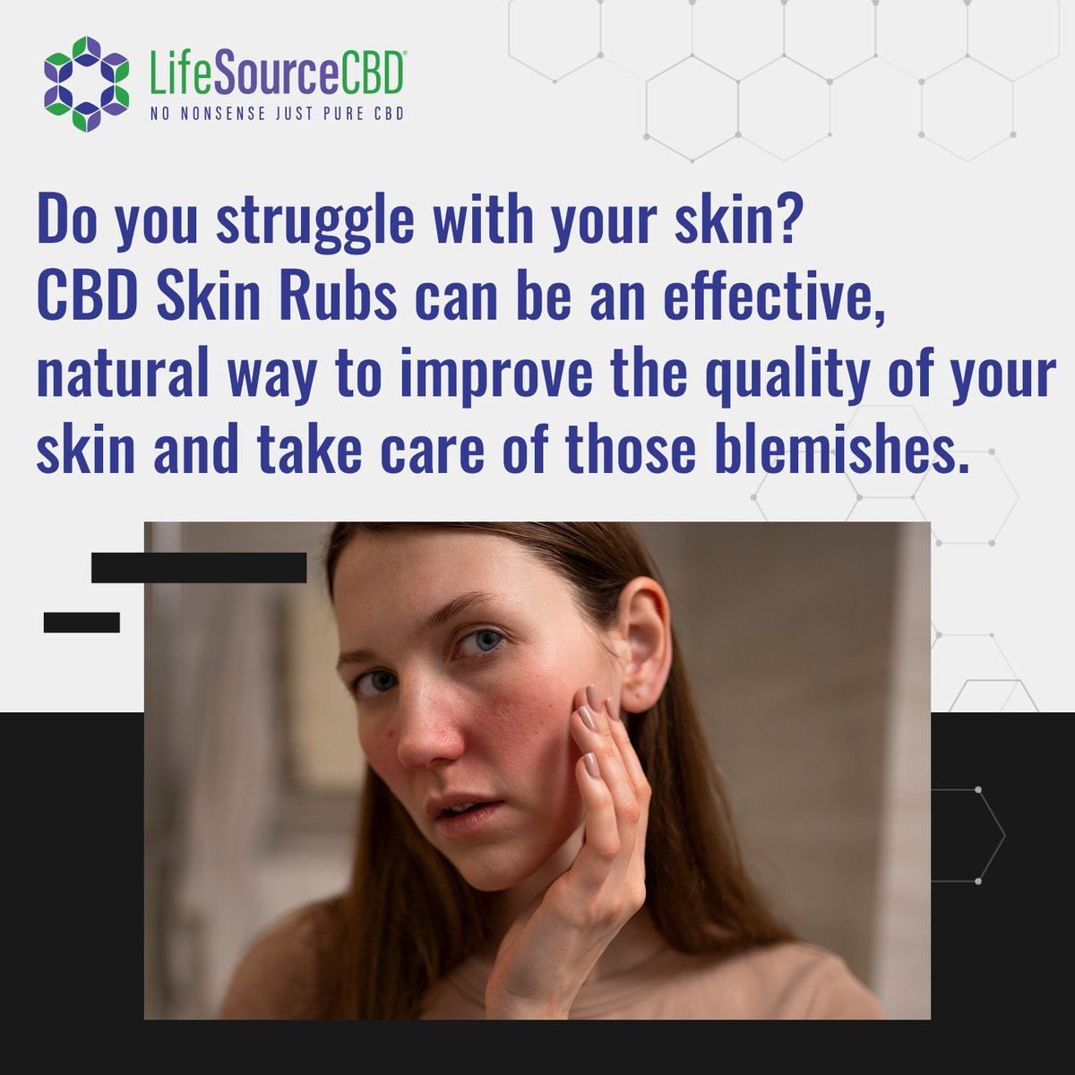 lifesourcecbd's tweet image. Struggling with your skin? 

CBD Skin Rubs might be just what you need to give your skin a boost and achieve that healthy glow! ✨

#cbd #thc #hemp #cannabiscommunity #cbdoil #cbdhealth #cbdproducts #cannabisculture #cbdlife #cbdmovement #cbdcommunity #cbdwellness #health