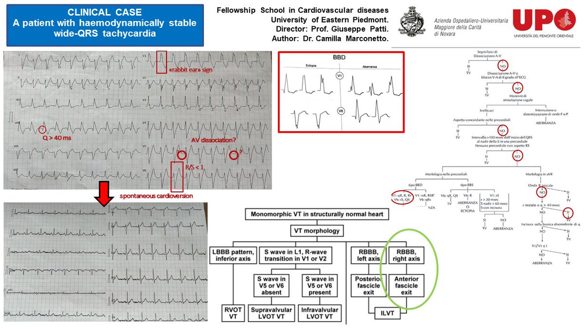 CardioNovara's tweet photo. Cardiology meeting (May 25th, 2023) presented by Dr. C. Marconetto, under the supervision of Prof. G. Patti, Full Professor of Cardiovascular Diseases (CVDs) at University of Eastern Piedmont and Director of the Department of Thoracic and CVDs at Maggiore della Carità Hospital https://t.co/RlOv9n8Hzo