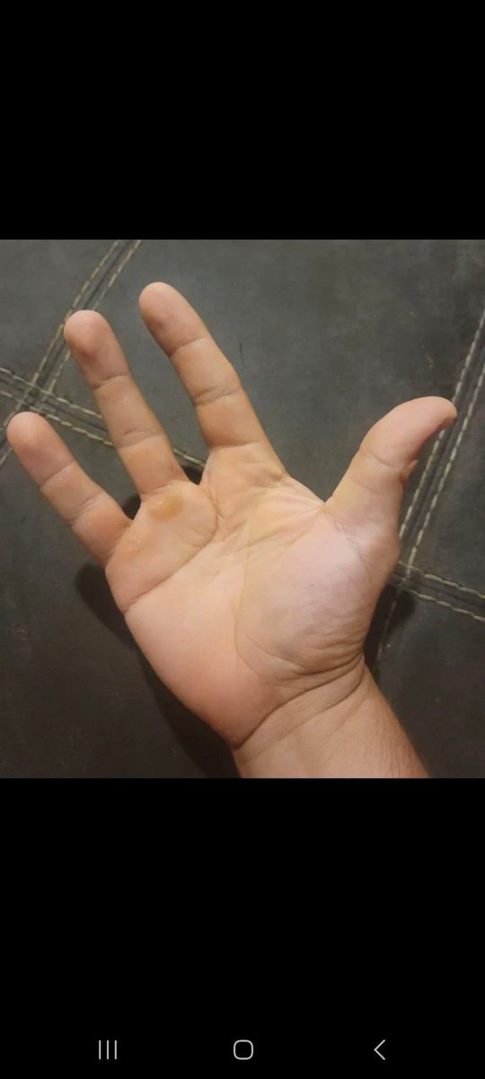 Hey <a href="/cz_binance/">CZ 🔶 BNB</a> I chop my finger to support you 
Please support $Ben @Bitboy_Crypto help mass adoption and fight for crypto right 🙏