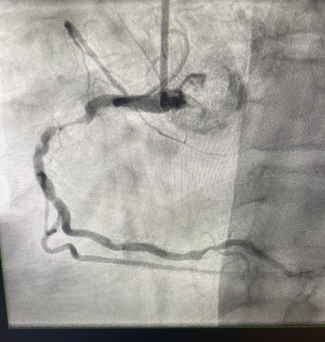 Anish Koka, MD tweet media