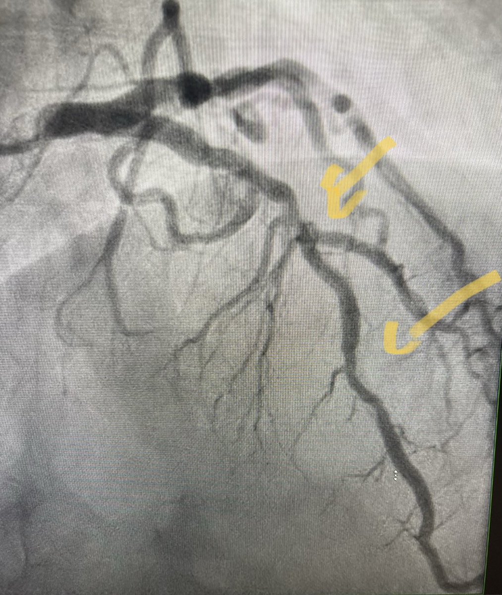 Anish Koka, MD tweet media