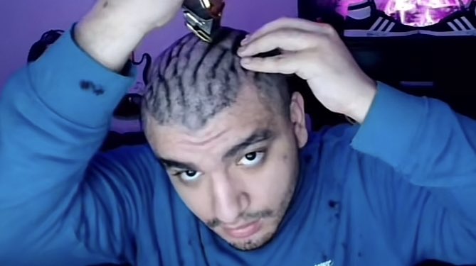 Porque vergas tiene la cabeza así