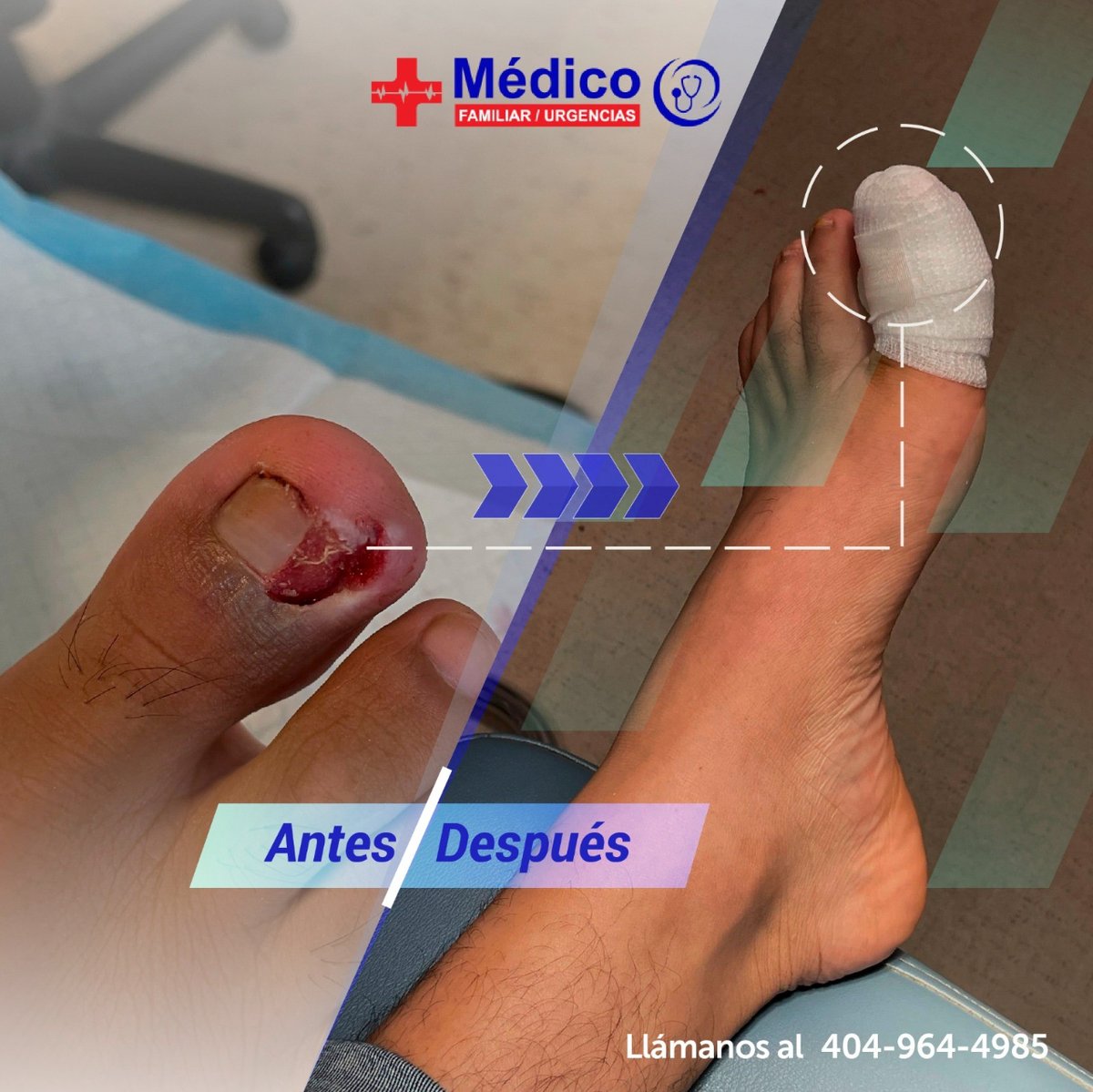 CentroMedicoAtl's tweet photo. ¿Lesiones en tus uñas?. En centro médico atlanta podemos ayudarte 🏥 🤩❤️🩹

Llámanos al 📞404-964-4985 o escríbenos al 💬470-838-1398

#centromedicoatlanta #atlanta #prevencion #salud #enfermedades https://t.co/x9YUsiQDmV