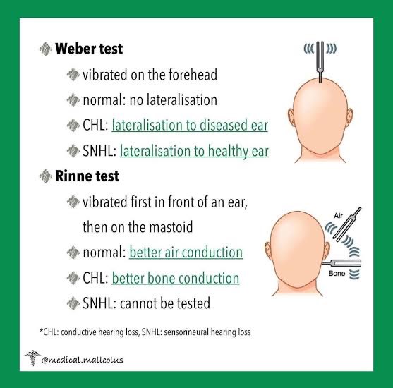 MxM_1112's tweet photo. Simple illustrations &amp; notes about Weber test &amp; Rinne test https://t.co/yY1k2mUQhu