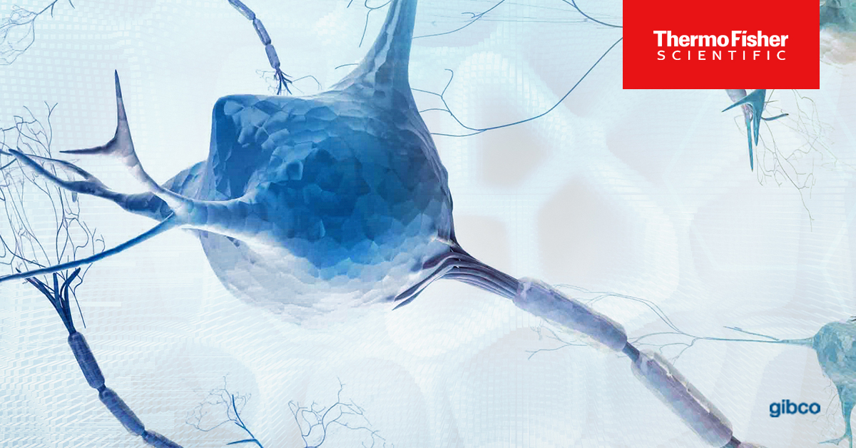 📚🧠 Dive into the world of Neurobiology! Get your FREE Gibco Neurobiology Handbook

🎁🧪 Unlock a treasure trove of protocols, solutions, and resources curated by our experienced scientists - spr.ly/6017Oq0hl

#Neurobiology #Handbook #FreeResource #LabLife #Neuroscience