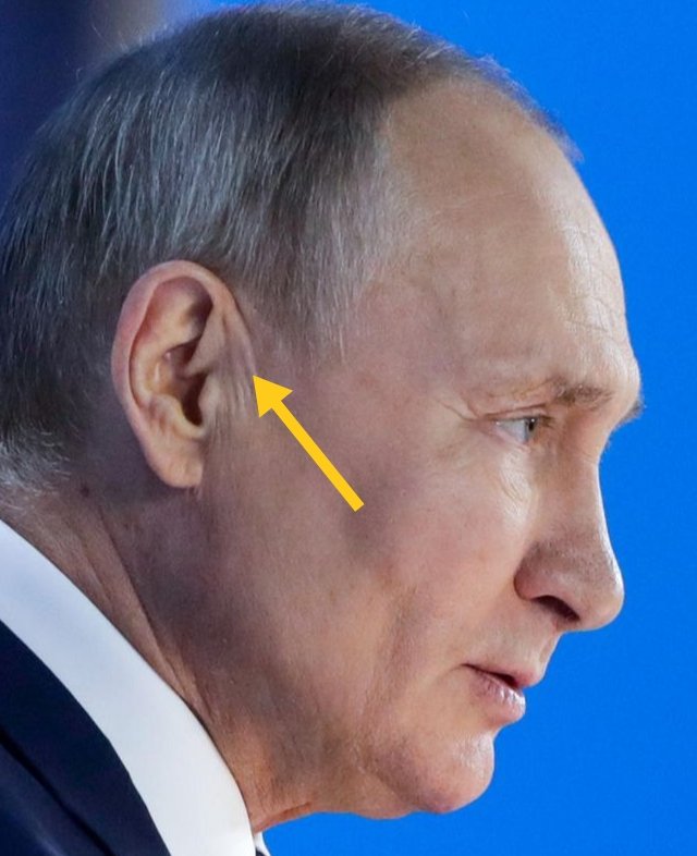 Angeblicher Putin heute bei einem Interview.
Man sieht deutlich, dass die Ohrfalten fehlen. Auch wirkt das gesamte Gesicht wie eine Maske.
Und diesen Lügner und Verbrecher verteidigen direkt oder indirekt unsere Putinknechte in 🇩🇪
#Moskau #Unfassbar #Den_Haag