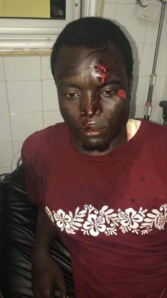 Fode9122's tweet photo. Tous les membres de APR sont armés voilà un jeune homme qui est touché par balles en pleine tête.
Fayantou la niou dieum walahi kou artéwoul dingua atté. https://t.co/Kxw1zwlwwn
