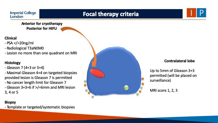 It’s come to the point where if you don’t offer focal therapy in your centre, you should offer referral to a unit that does

In UK at least, you’re breaking informed consent legal precedence, if you do not

Here are the focal therapy criteria

NB: NICE IPG &amp; EAU guideline covered