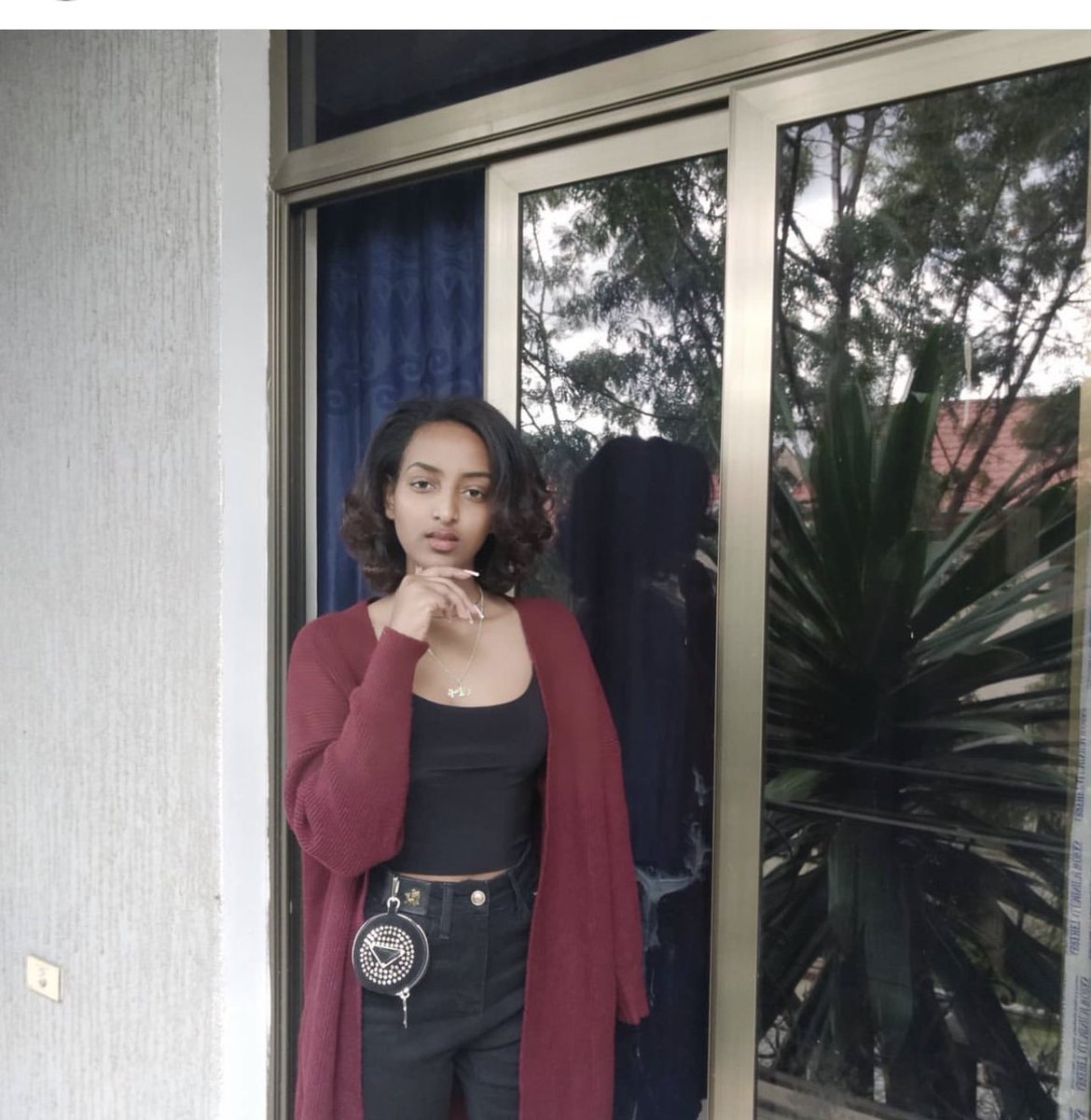 I’m avictim of the war on #Tigray my right arm is amputated and my right side hip bone is broken in multiple parts. I get this problem cause I said no for rape! My message for the GBV victims don’t be ashamed.it’s them who should feel ashamed. #TigrayGenocide