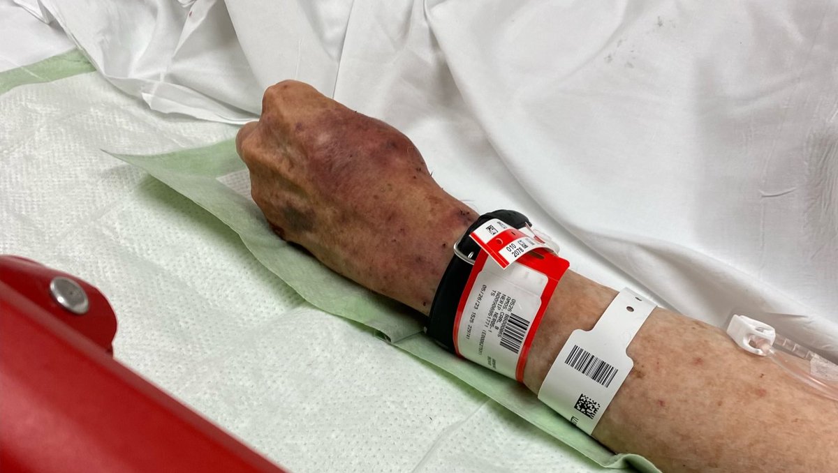 Chris Yu tweet media