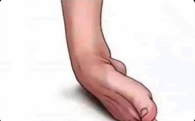Nadie:

-Mi tobillo sin motivo alguno cuando ando por la calle: