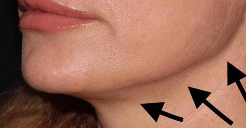 OfficialBHMD's tweet photo. Doctor: “Doing This Every Morning Can Snap Back Aging Skin (No Creams Needed)”