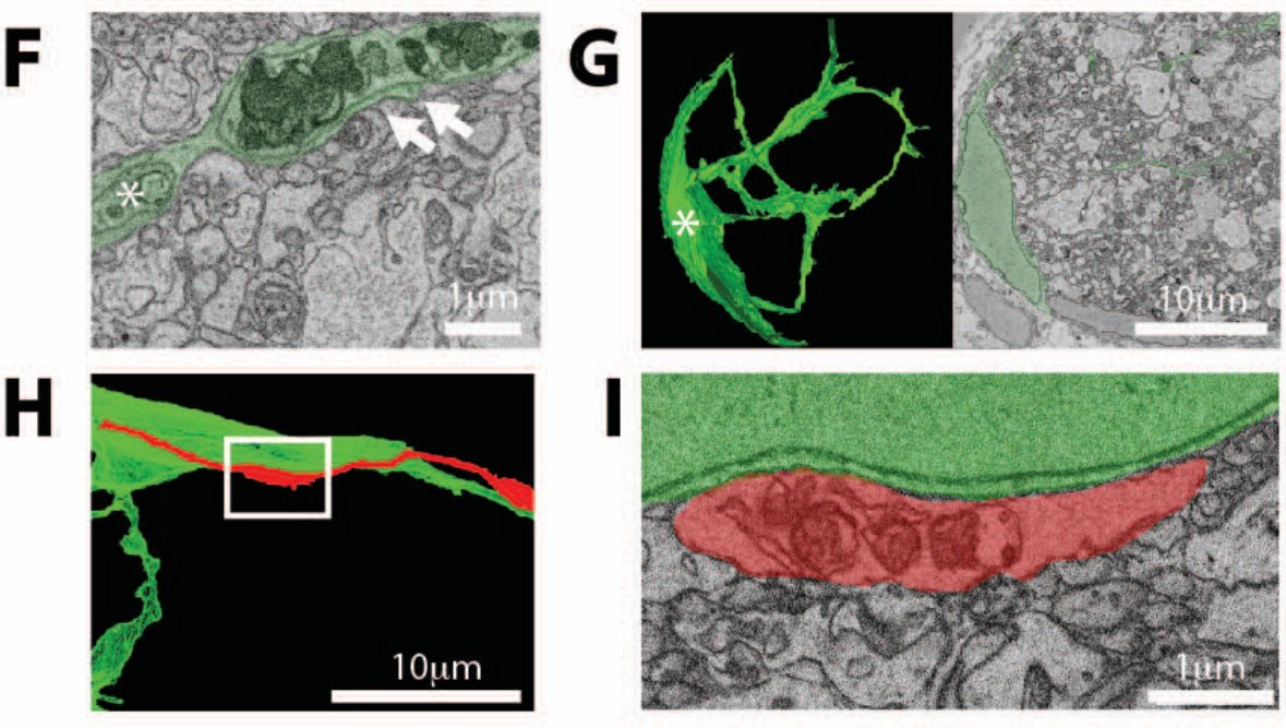 Finally, in collaboration with Mark Ellisman’s group at UCSD, we performed correlated light and volumetric electron microscopy. Using this technique, we were able to show by ultrastructure that optineurin-containing axonal debris is transferred to optic nerve astrocytes!