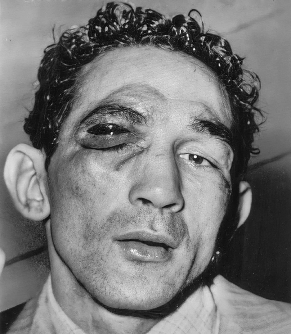 _laylowwwww's tweet photo. @WBCBoxing Y’all saying willie pep and it’s a picture of him out there like this😂😂 https://t.co/4tAjw5CrYL