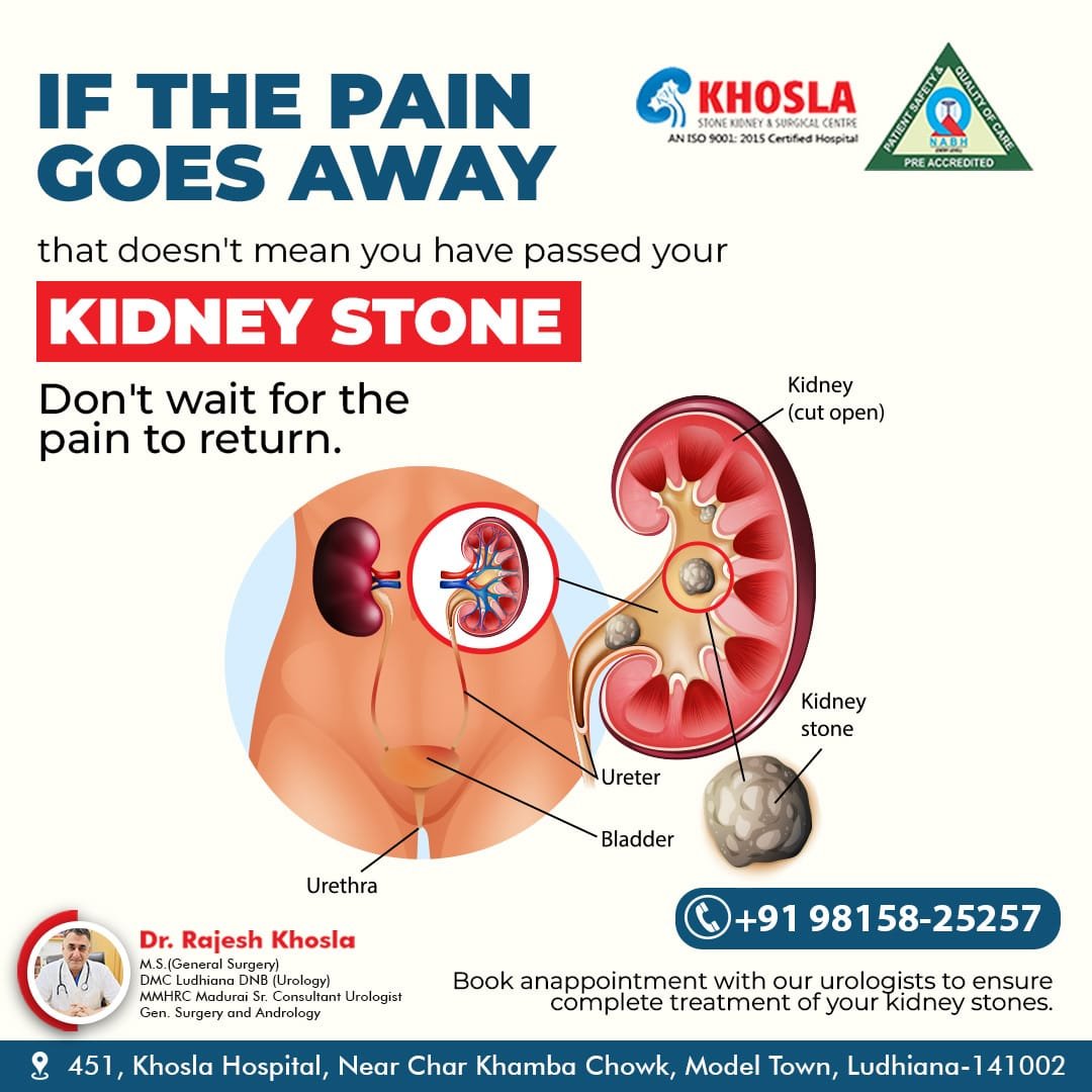 Pain-free doesn't mean stone-free! 
Visit us for advanced kidney stone treatment ,
Book an appointment now 
Contact: 98158-25257

#khoslastonekidney #kidneyhealth #ludhiana #punjab #homeremedy #panchakarma #doctor #kidneyfunction  #expert #surgery #hidden  #treatment