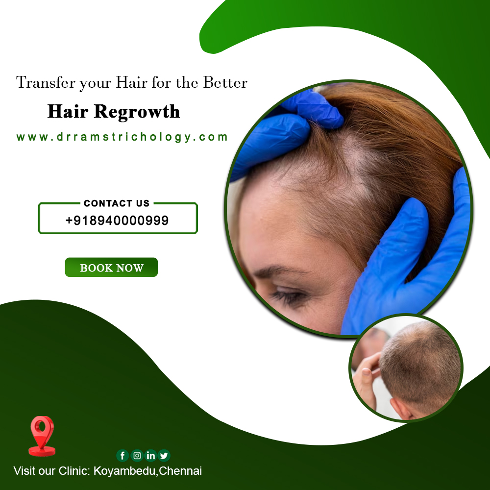 ✅Dr.Ram's Trichology and Aesthetics
✔ HAIR REGROWTH
☎ Book Your Appointment Now : +91 8940000999
📍 Location : Koyambedu
#hairgrowth #hair #haircare #naturalhair #healthyhair #hairgoals #hairloss #hairstyles #beauty #curlyhair #hairtransformation #natural #longhair