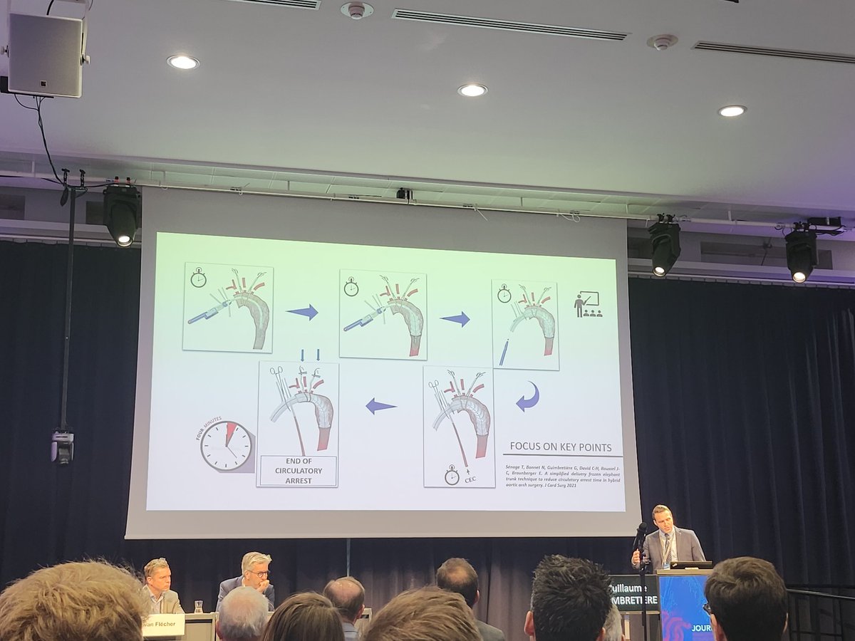 so_vasse's tweet photo. Reprise des présentations aux #JFEF à Nantes
Nouvelle approche de la #FET dans les dissections aortiques en normothermie.
#SFCTCV @ajctcv @MarieJungling https://t.co/jFd9zl5cCO