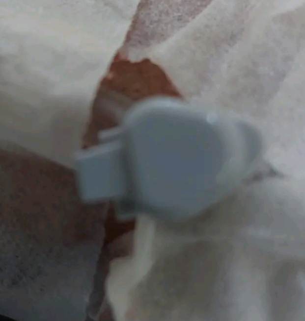 jelibee2022's tweet photo. Wen u thinking ur in for simple maintenance ivf n the Dr puts a damm Grey g16 cannula ....
I think the Dr hates me 🙄 https://t.co/KFuywj0kGG