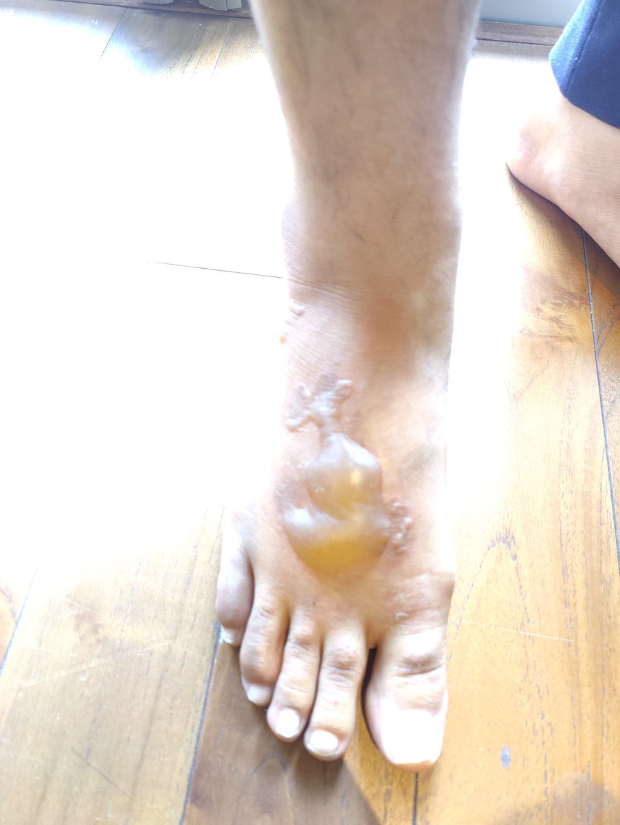 agarwalkirti614's tweet image. 2/3 Did not create a scene that time as we didn&apos;t want the pantry boy to lose his job! Just asked the catering company to stop serving hot water like that.. instead they should serve it in a thermos flask!