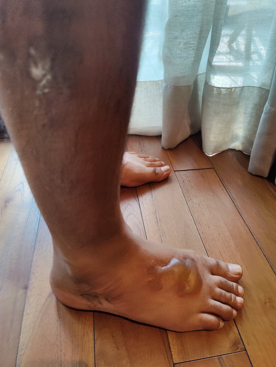 agarwalkirti614's tweet image. 3/3 But sadly today again while returning ( NJLP to howrah) , boiled water being served same way..not learning from its mistakes! Sad state of affairs #irctc #indianrailways #VandeBharatExpress @RailMinIndia @AshwiniVaishnaw @PMOIndia