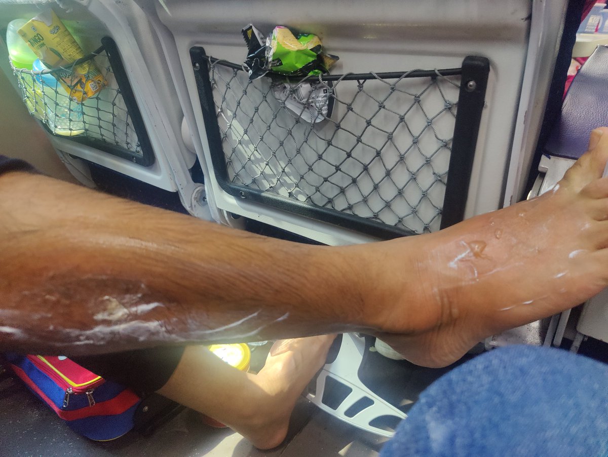 agarwalkirti614's tweet image. 3/3 But sadly today again while returning ( NJLP to howrah) , boiled water being served same way..not learning from its mistakes! Sad state of affairs #irctc #indianrailways #VandeBharatExpress @RailMinIndia @AshwiniVaishnaw @PMOIndia