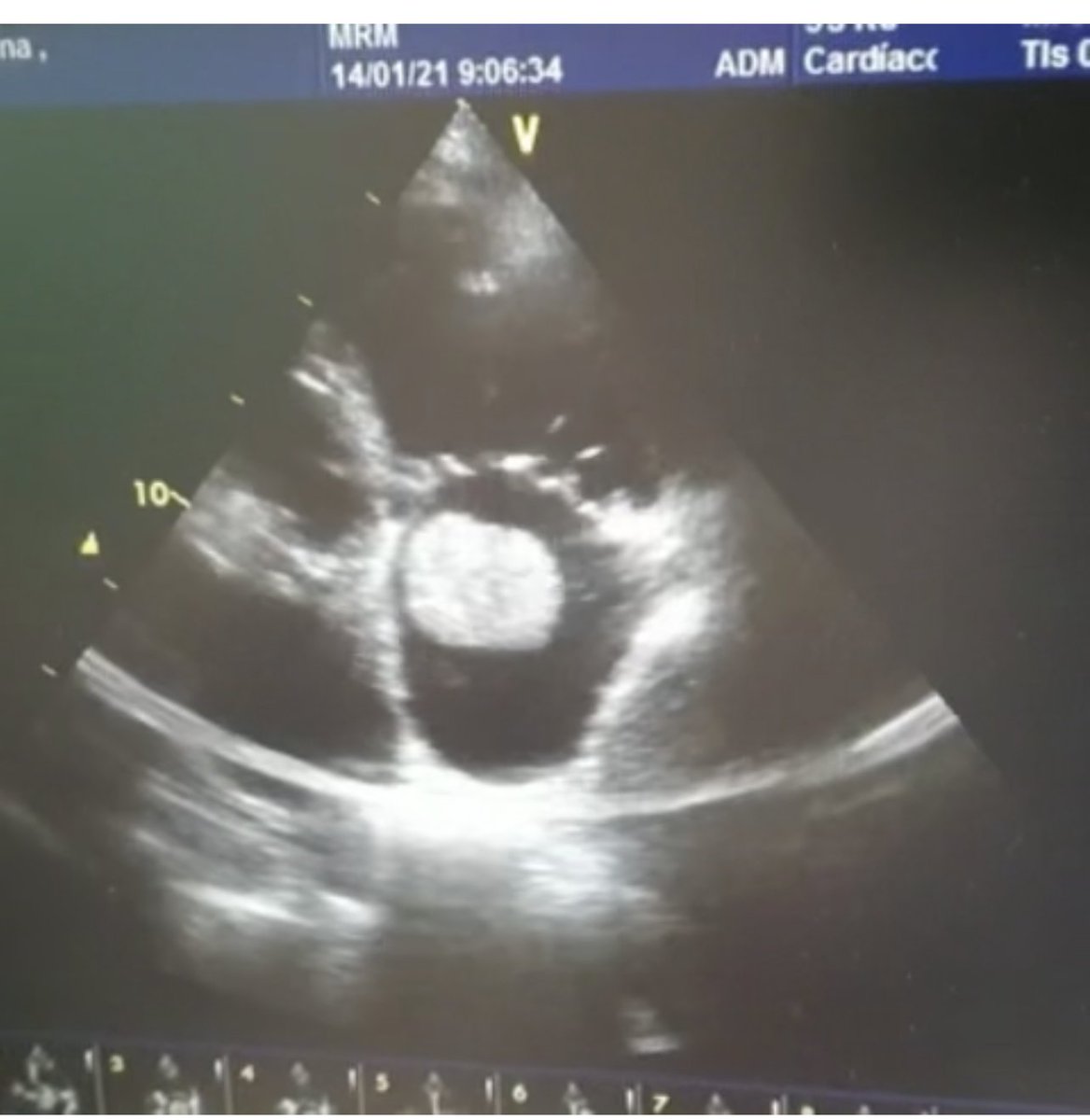 European Society of Cardiology tweet media