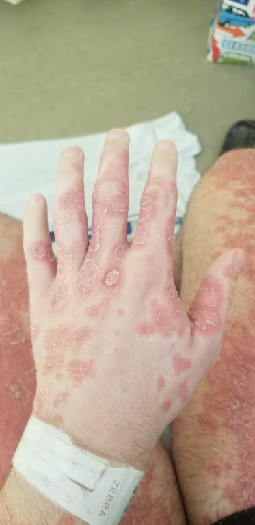 PsoriasisUK's tweet photo. "If somebody gives you a hard time about your appearance, it says far more about them than it does you. There is far more to you than a condition that you were born with."

Read Oscar's story here https://t.co/s5lGQpZTsb https://t.co/tZ3Tmxwrfu