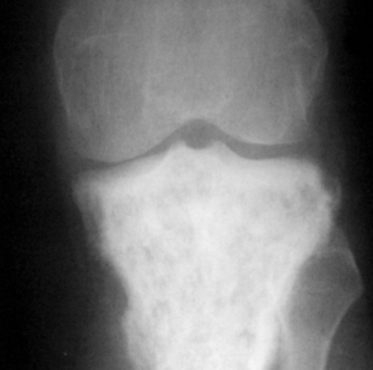 radRounds's tweet photo. What is your diagnosis?  Answer = https://t.co/EYK3vQph1C https://t.co/1qFsSdlsJq
