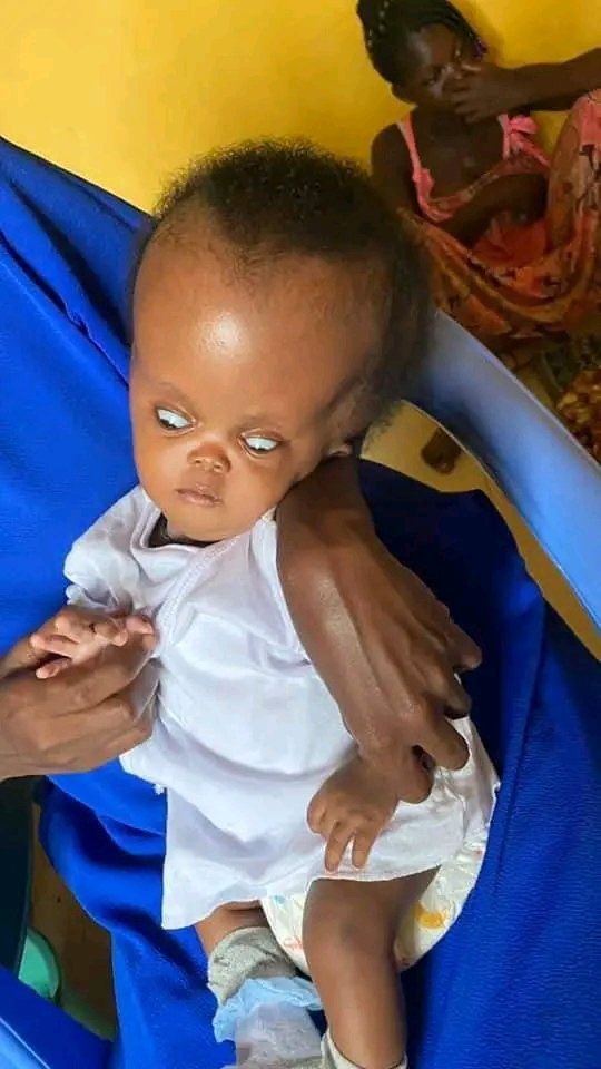 Kayjnr10's tweet photo. Kindly Support baby Mariam who was born  months ago with excess fluid in the brain(Congenital hydrocephalus) and needs an urgent surgery to pull out the fluid in order to avoid brain damage, mental &amp; physical problems.

Momo Number :0598614919
Name : MY JOY JOINT ❤️ https://t.co/YOpGAlagSN