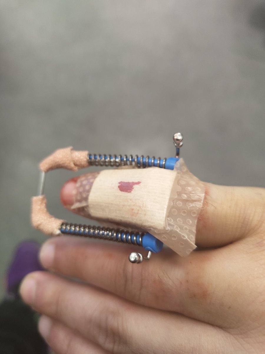 We can rebuild him, faster, stronger