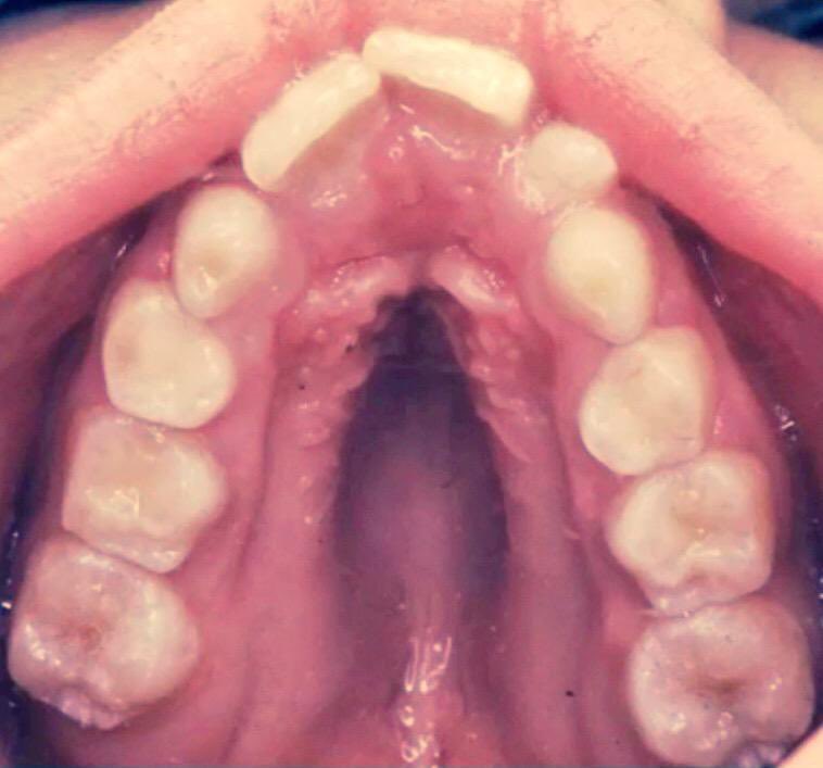 drkeithsiau's tweet photo. Incidental finding in a patient with abdominal pain. What’s the diagnosis? https://t.co/P92eJw2xhs