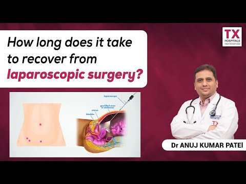 How Long Does It Take to Recover From Laparoscopic Surgery?|Dr.Anuj Kumar Patel|TX Hospitals
youtube.com/watch?v=ATUNAU…

Visit us:
🌍txhospitals.in
CRM NO: 9089489089
#TXHospitals #txhospitalsbanjarahills #Laparoscopicsurgery #Laparoscopicsurgeryrecoverytime