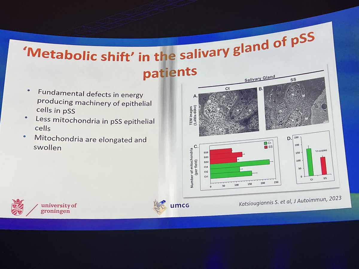 Could mitochondria play a role in the pathogenesis of Sjogrens disease?!

#Eular2023