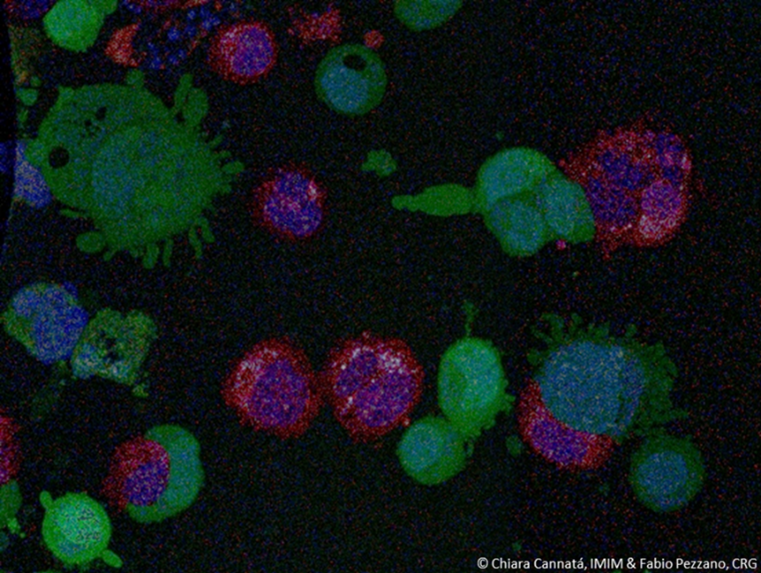 CRGenomica's tweet photo. PLAST_CELL studies #metastasis by looking at genetic plasticity, a key trait of cancer cells. By developing an innovative microfluidics platform, it will quantify tumor plasticity to predict cancer aggressiveness, creating a powerful tool for cancer research and therapy. https://t.co/TbkLHj486t