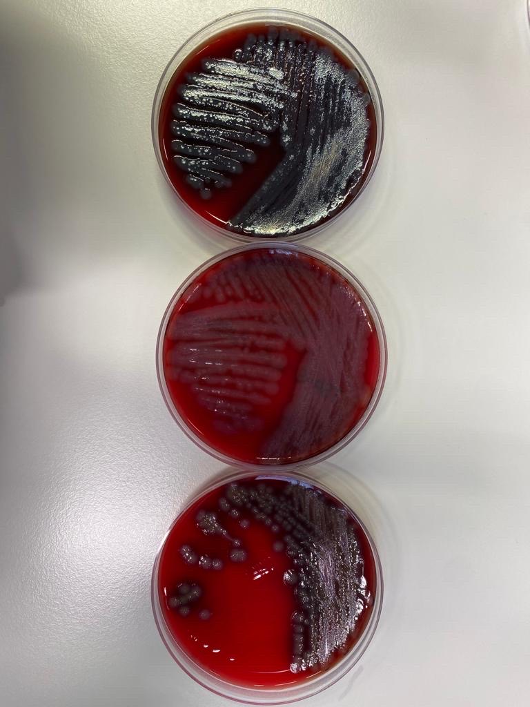 Exciting news!! Collection of CR-PA isolates from patients, healthy humans, the hospital environment, and water has finished in Jakarta (Indonesia) and Rotterdam (The Netherlands), and is in full swing in Rome (Italy)!