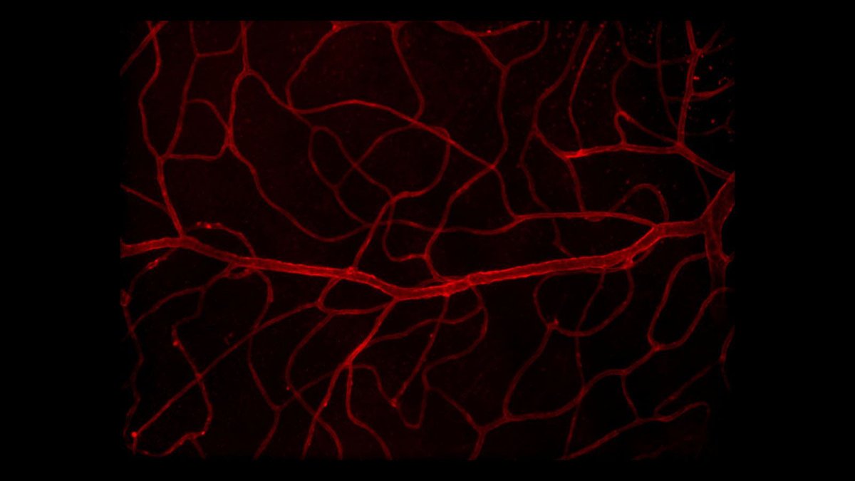 Human BioMolecular Atlas Program (HuBMAP) (@_hubmap) on Twitter photo <a href="/_hubmap/">Human BioMolecular Atlas Program (HuBMAP)</a> researcher <a href="/angelakrusephd/">Dr. Angela R Kruse</a> vision brought this #3DMicroscopy image of the vasculature in the retina to light! And for those of you who are grateful the cornea puns are at a minimum, these aren’t puns, they are optical allusions 📷
<a href="/SpragginsLab/">Spraggins Lab</a> #CataractAwarenessMonth <a href="/_hubmap/">Human BioMolecular Atlas Program (HuBMAP)</a> researcher <a href="/angelakrusephd/">Dr. Angela R Kruse</a> vision brought this #3DMicroscopy image of the vasculature in the retina to light! And for those of you who are grateful the cornea puns are at a minimum, these aren’t puns, they are optical allusions 📷
<a href="/SpragginsLab/">Spraggins Lab</a> #CataractAwarenessMonth
