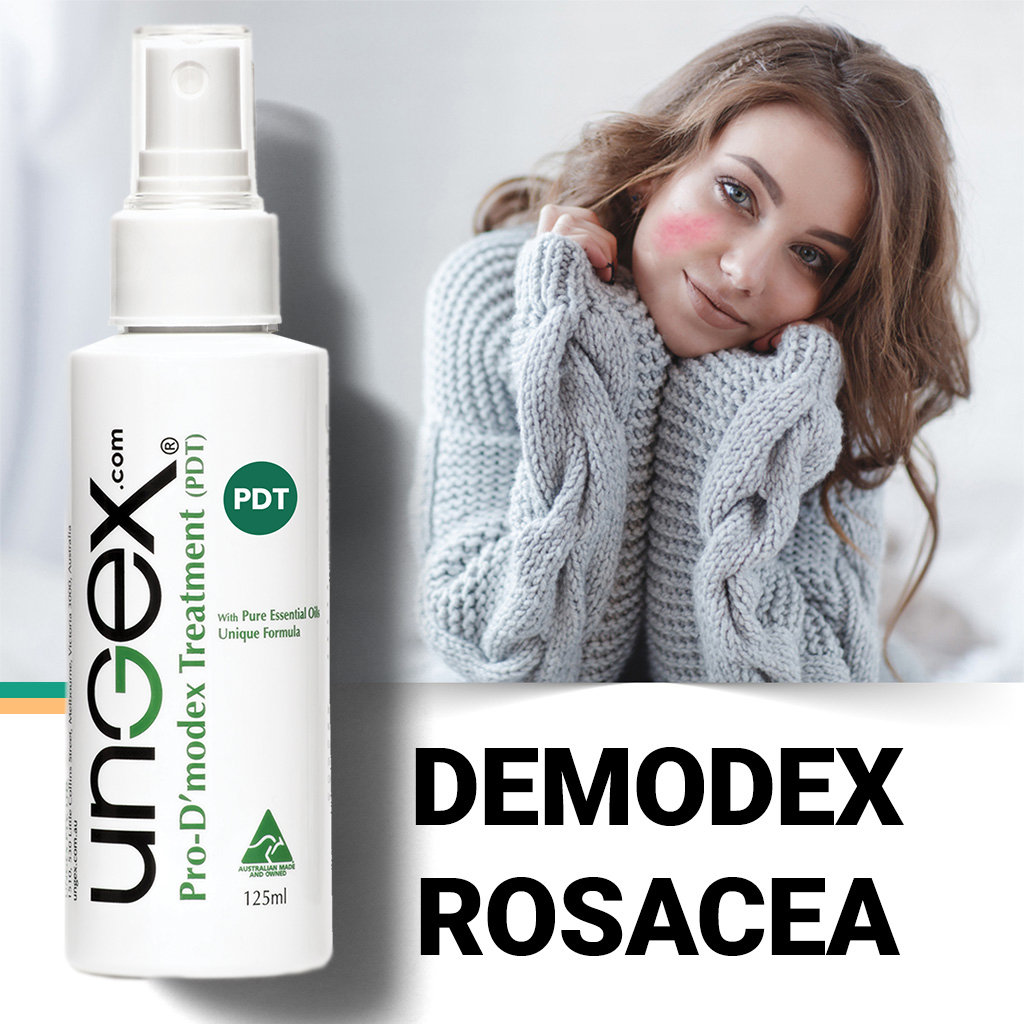 Introducing the newest star in my #Etsy store: #Ungex Pro #Demodex Treatment! Perfect solution for #Acne #Rosacea, #Demodicosis, #Eczema, and more. Revamp your #skincare routine: etsy.me/3MGjA1L #EtsyFind #DemodexSolution #AcneCare #RosaceaRelief