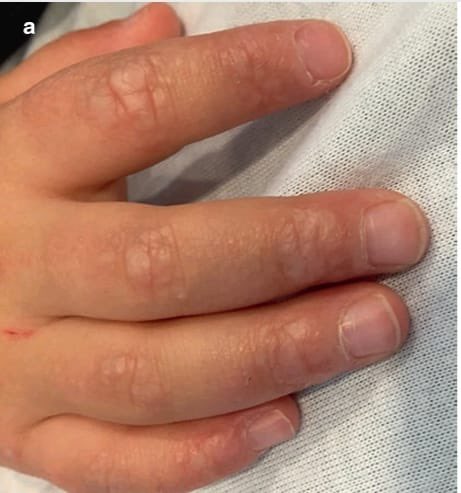 Rohit Aggarwal on Twitter: