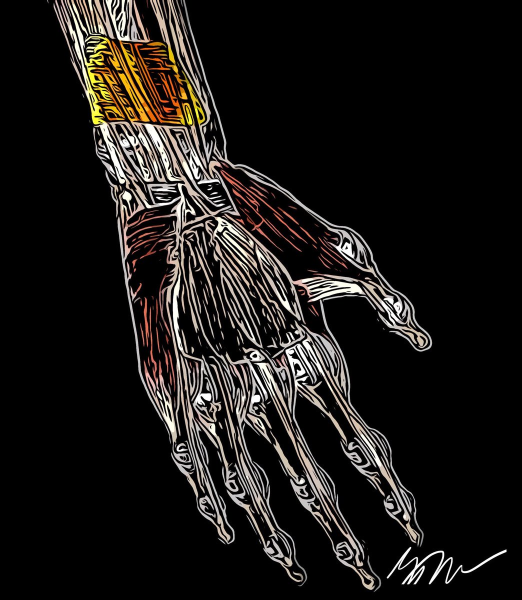 Pronator Quadratus

1/1 NFT of every muscle, ligament and bone in the body. 
Receive a free canvas wall art with each mint. 
20% donated to The American Heart Association 
20% donated to The Foundation for Physical Therapy Research