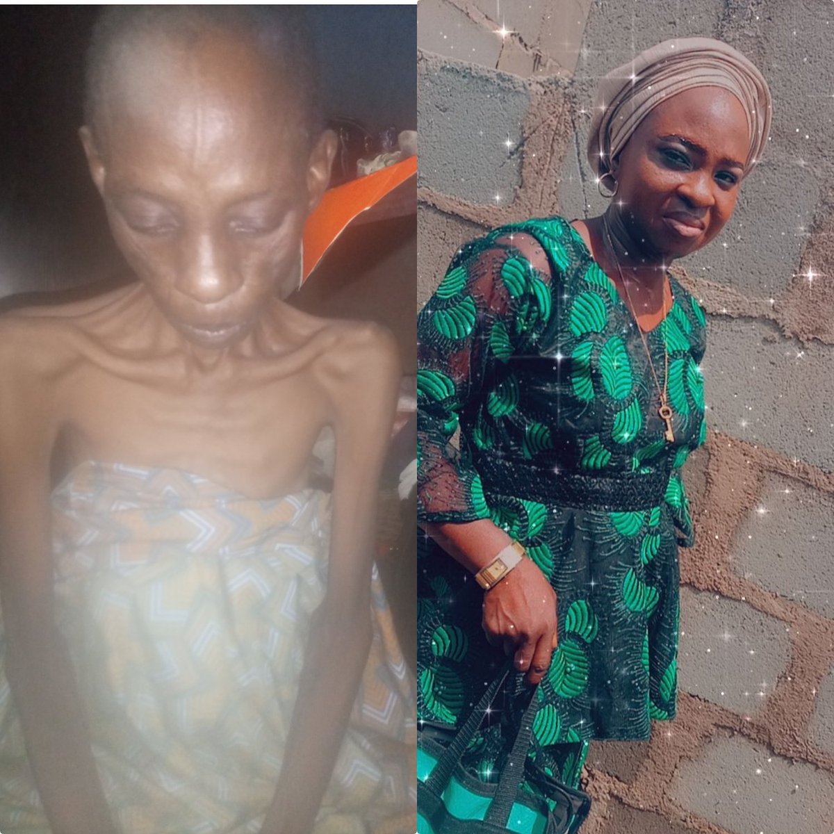 If you come across this kindly retweet 🙏🙏 My mother have been battling with sickness for over a year. We have paid for different tests before we were finally told that she is suffering from colon cancer. Now we were told to get 6.650,520 The operation is in 6 different batches