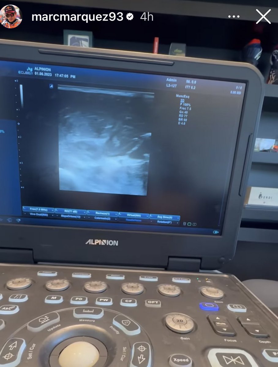 Me he perdido… Voy a ser tío?