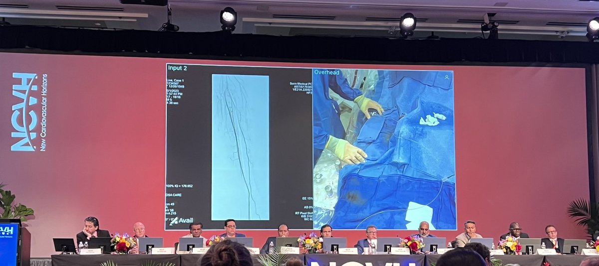 New to me at #NCVH2023…using a #PedalFirst approach to diagnostic peripheral angiography. I firmly believe in a #RadialFirst approach to coronary disease so I suppose this makes sense but wonder if this is commonplace?