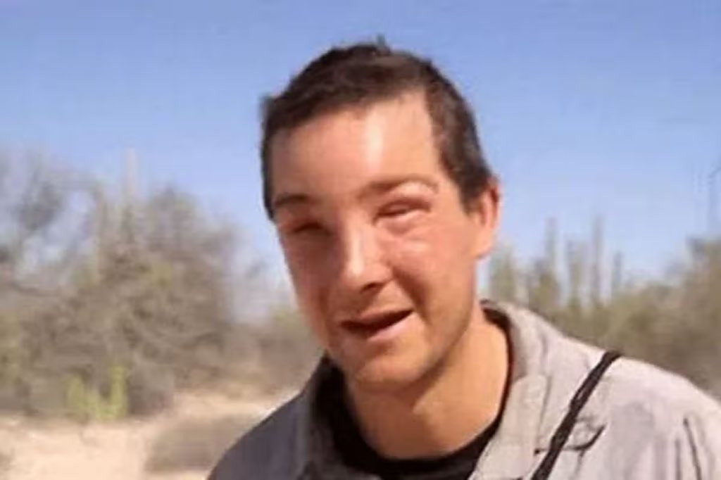 why’s he look like bear grylls after a bee sting